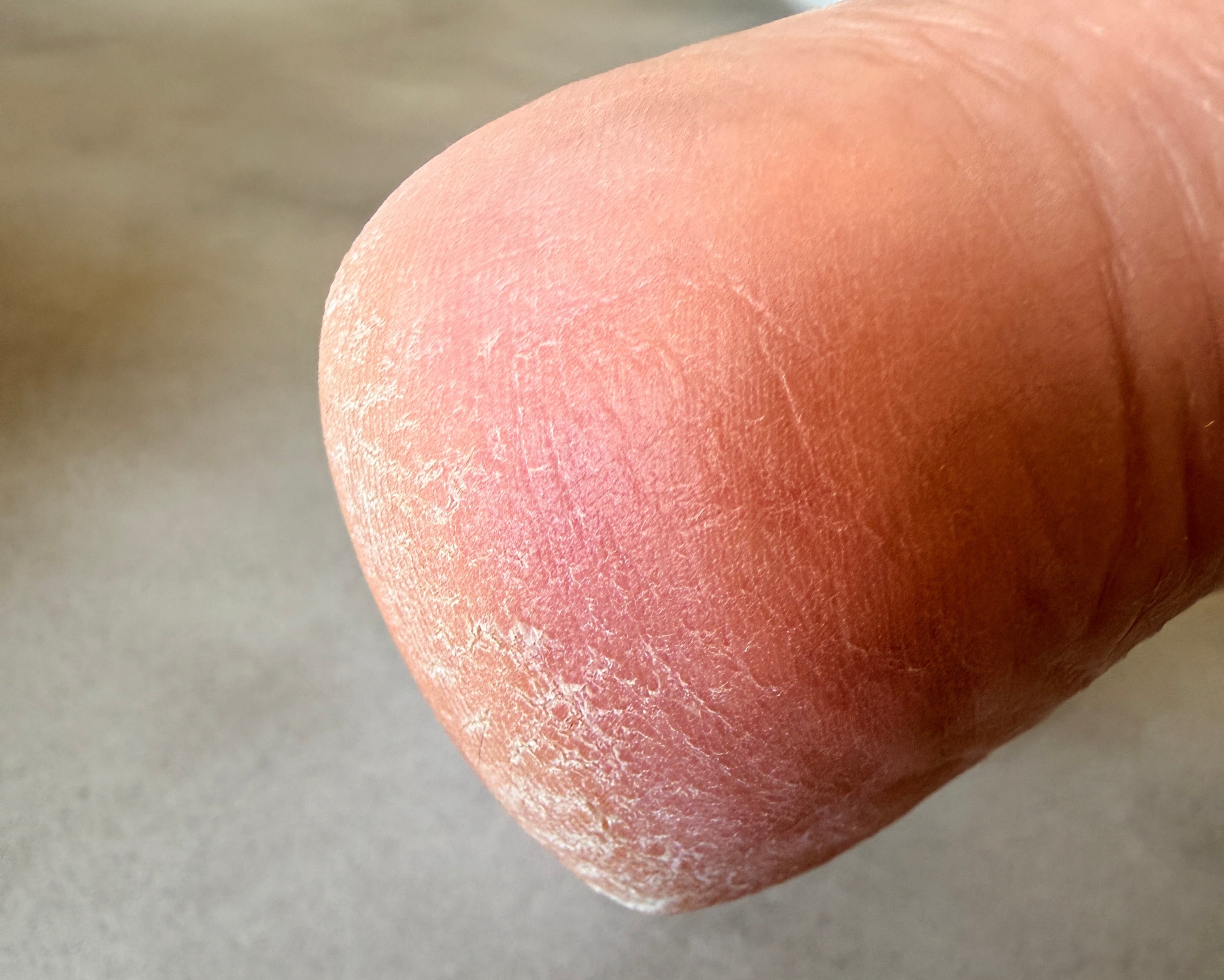 Close-up of a heal with a dry cracked skin on a neutral background